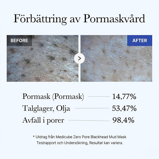 Medicube Zero Pore Blackhead Mud Mask 100 g