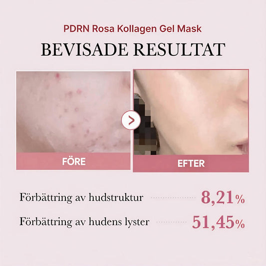 Medicube PDRN Pink Collagen Gel Mask 4 st