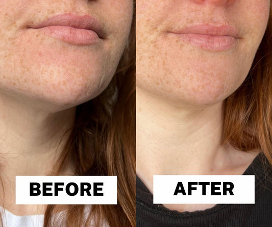 La Roche Posay Hyalu B5 Anti-Wrinkle Repairing & Replumping Serum 30ml