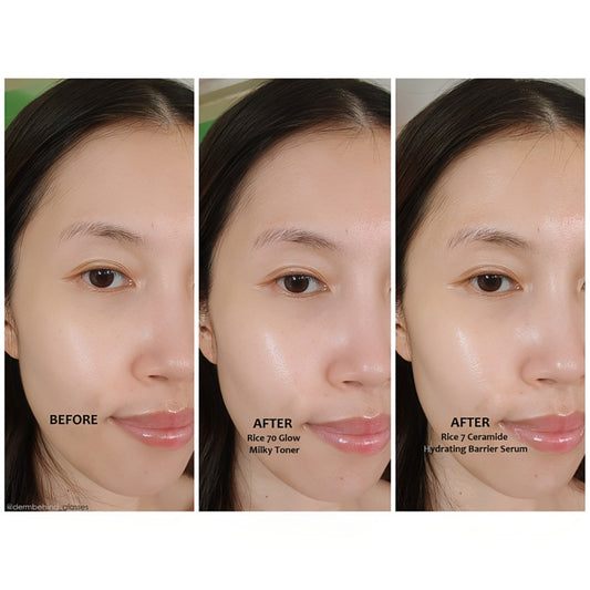 Anua 7 Rice Ceramide Hydrating Barrier Serum 50ml