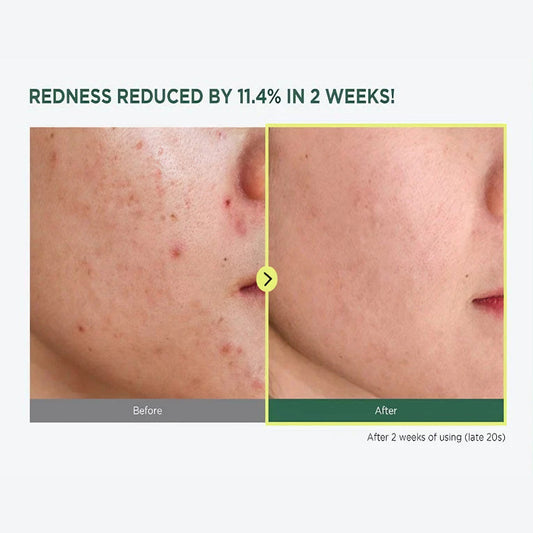 Anua Heartleaf 77% Soothing Toner 250 ml