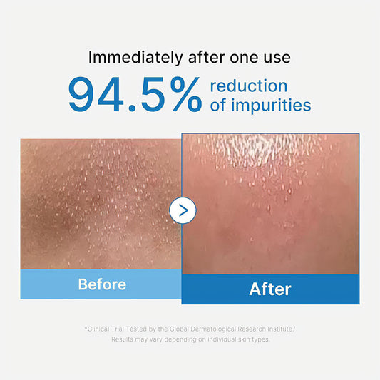 Medicube Zero Pore Blackhead Deep Cleansing Oil 205ml