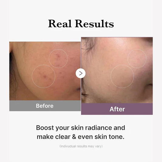 Medicube Age-R Glutathione Glow Serum 30g