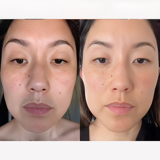 La Roche Posay Retinol B3 Anti-Ageing Serum 30ml