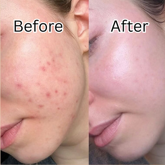 Dr. Althea 345 Relief Cream Mist 60 ml