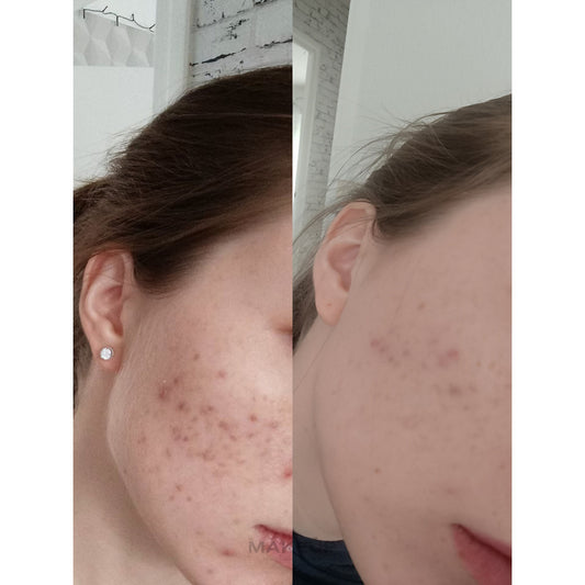 La Roche Posay Cicaplast Balm B5+ 100ml